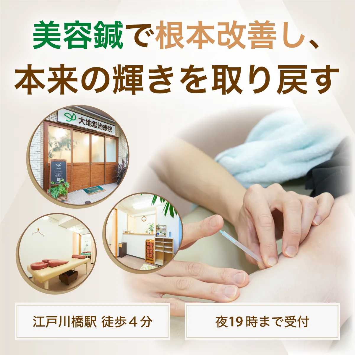 美容鍼で根本改善