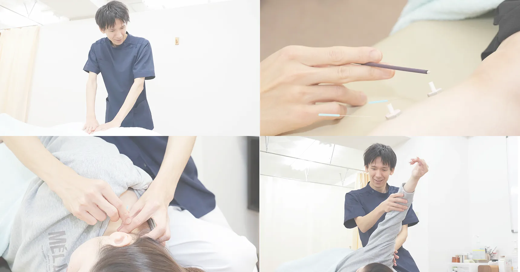 施術のイメージ